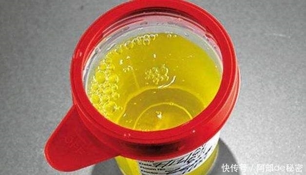 症状|心火过旺的5个表现,多吃4种食物,不失眠、不便秘、睡得香