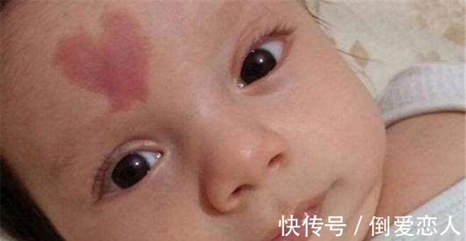 胎记|孩子出生身上有胎记,是孕期做这些事造成的,很多宝妈没在意