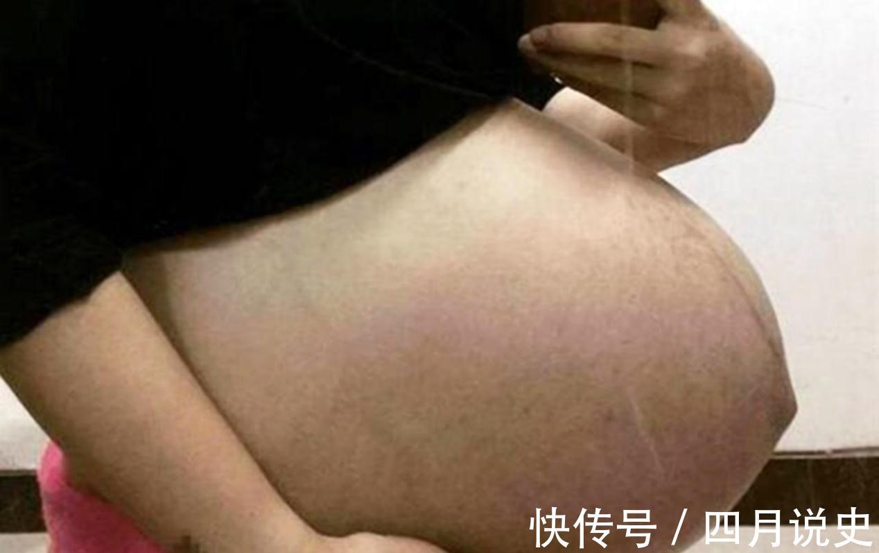 张琳|孕妇体内胎毒太多,会有什么表现?只要有这三个信号,就该排毒了