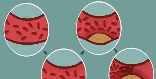 健身房|每天晚上抽出十分钟踮踮脚,坚持做的人,后来怎么样了?