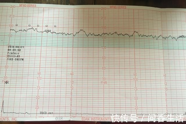 孕妈们|进行胎心监护，一会儿合格，一会儿不合格，是胎儿“缺氧”吗？