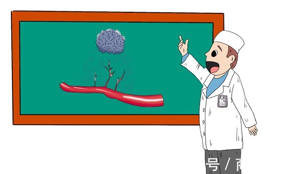 恢复|提醒得了癌症后，患者要敢于问4个问题，对病情恢复有帮助