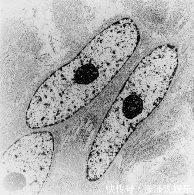 杀死|治好癌症不必杀死每个癌细胞!控制好它,当作慢性病带瘤生存即可