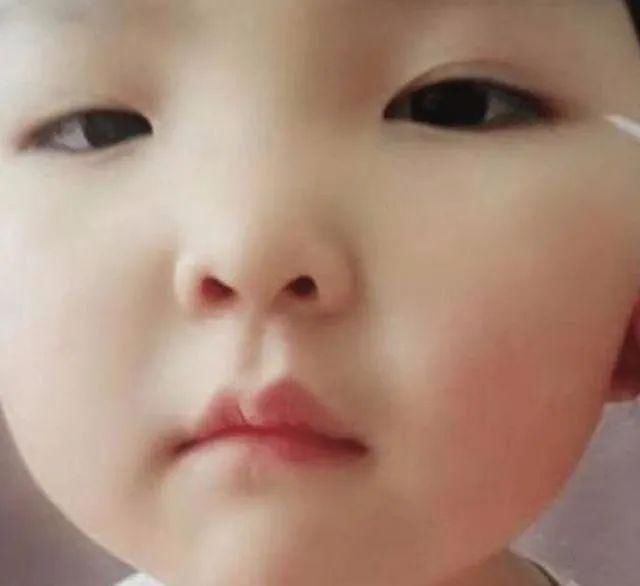 宝妈|孩子不是双眼皮,家长亲自给整成双眼皮,网友:无知