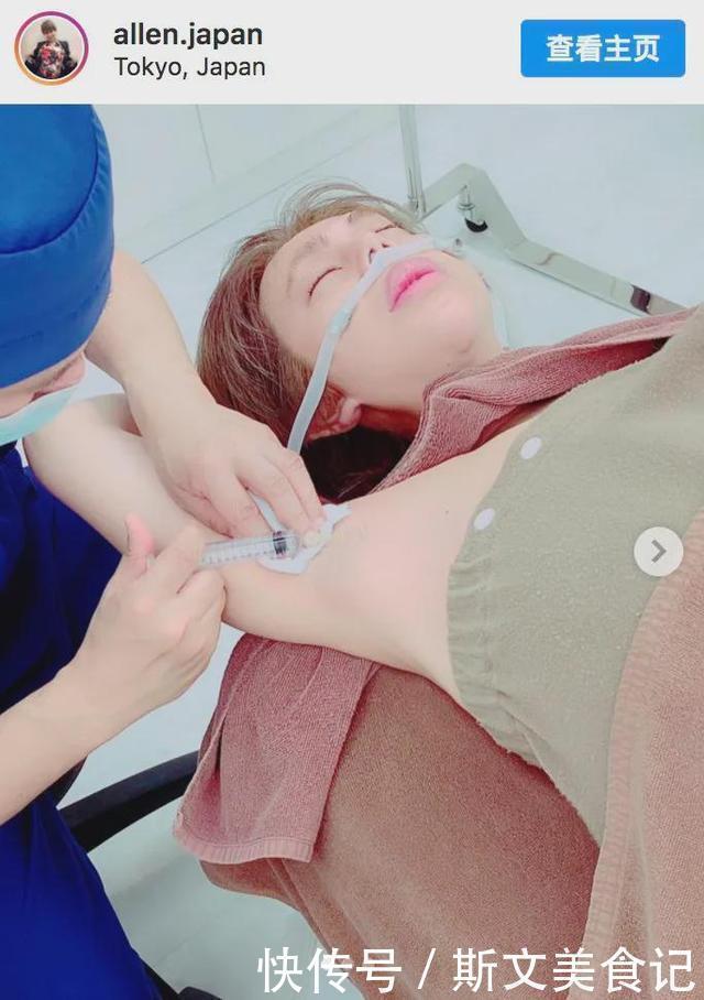 艾伦|日本一帅气小伙花1亿做全身整容，最后终于整成了“悲伤蛙”