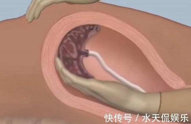 胎盘|生产后一小时内,身体都有哪些变化感慨母爱的伟大