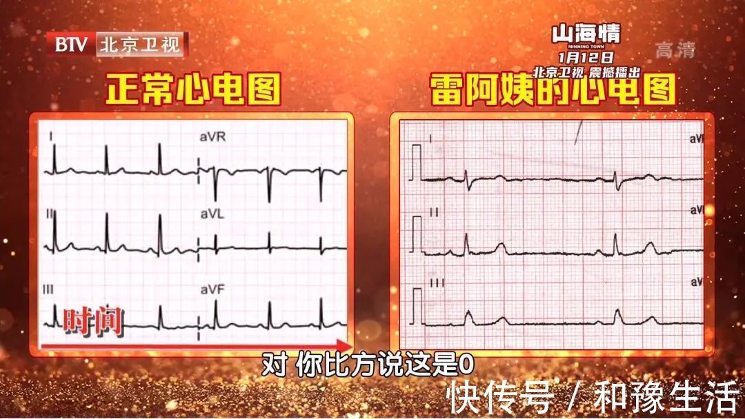 头晕头痛|心跳过慢、过快、乱跳,都是因为它出了问题!一个小方法,提早发现危机~