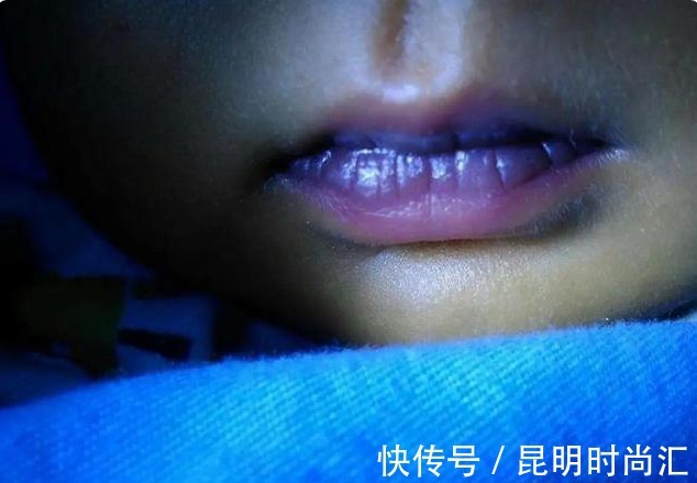 堵塞|血管堵塞的人,脸上会出现5种表现,若没有,恭喜你体内没有血栓