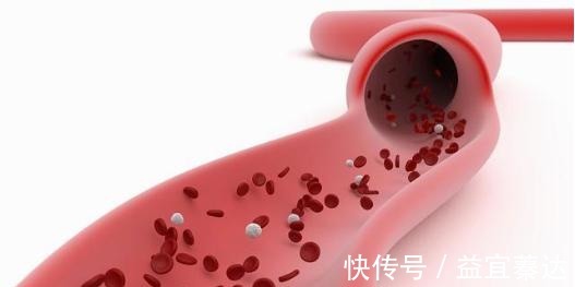 猪血|高血脂的“特效药”被发现, 每天吃一点, 血管通畅, 血脂轻松降!