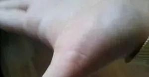 对症治疗|手掌上这块肉,一看就知道身体好不好!没事经常搓一搓,宣肺强心