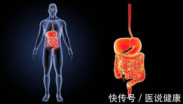 慢性疾病|肠道发生癌变,或与这4个因素相关,若你符合,需做好预防