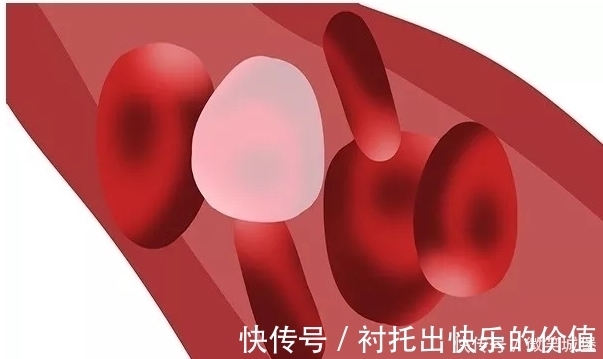 心脑血管|血管的“清洗剂”找到了,几块钱的食物,经常吃点,降脂清血管