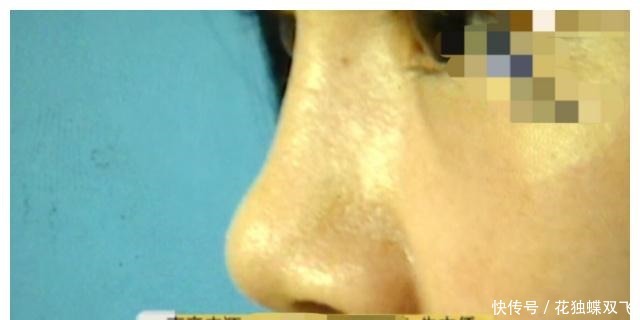 整形三年,老公也忍不了了花钱整成猪一样!女子曝光求助