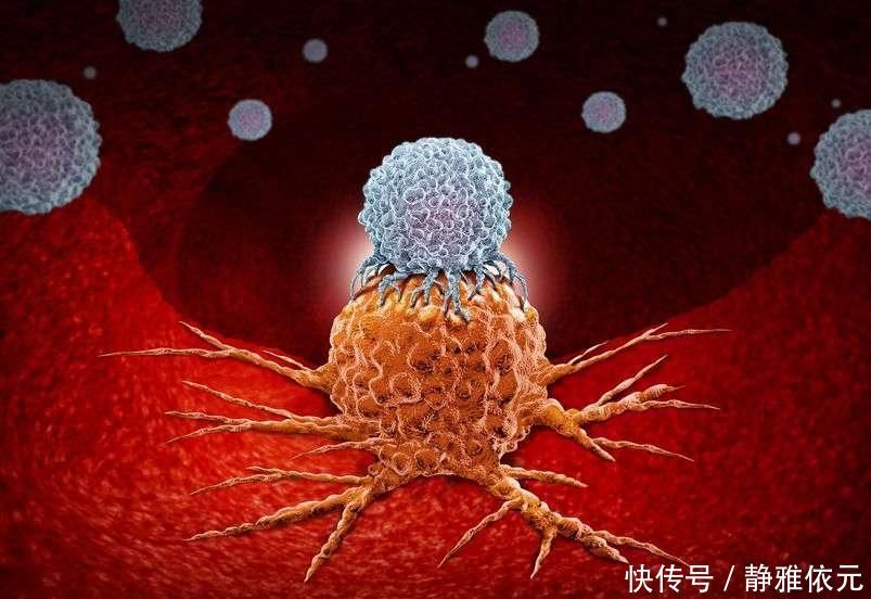 身体|癌症三年内没有复发，可高枕无忧？如何判断身体是否恢复