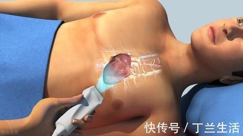 检查|什么是心脏彩超?能检查出什么疾病?听听医生怎么说