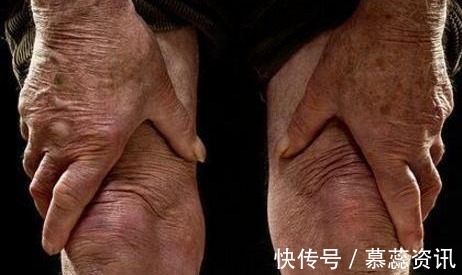 膝关节疼痛|膝关节炎反复折磨怎么办教你一个妙招就能调理,在家轻松做!