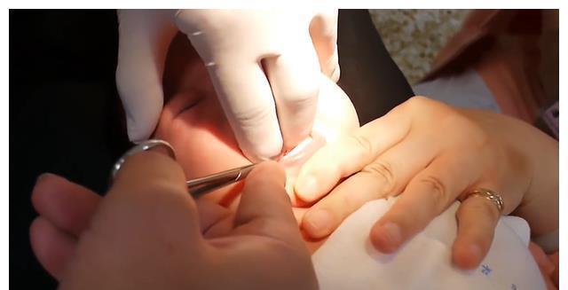 奶奶|宝宝1岁不会说话，奶奶怀疑没给孩子剪舌根，医生：回去吧治不了