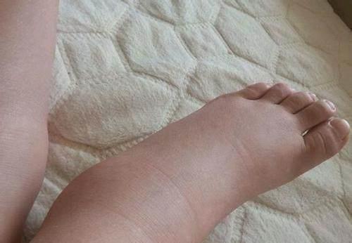 腹痛|孕期出现这几种情况,孕妈要赶快去医院检查