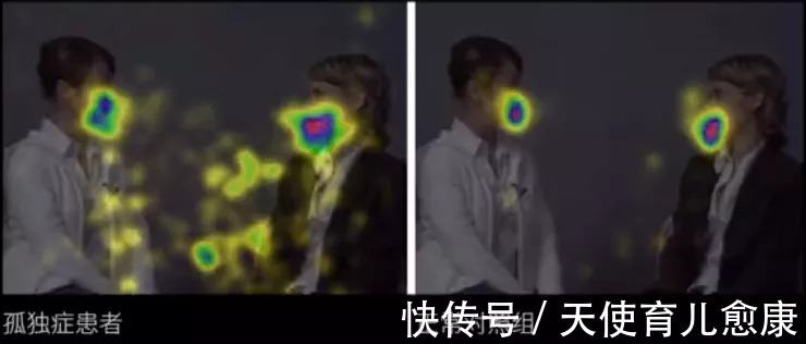 孩子|敏感还是迟钝?自闭症儿童的“感觉异常”到底是怎么回事?