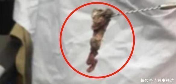 危险|3岁女儿浑身“恶臭”洗不掉,送医检查后,结果让妈妈现场作呕