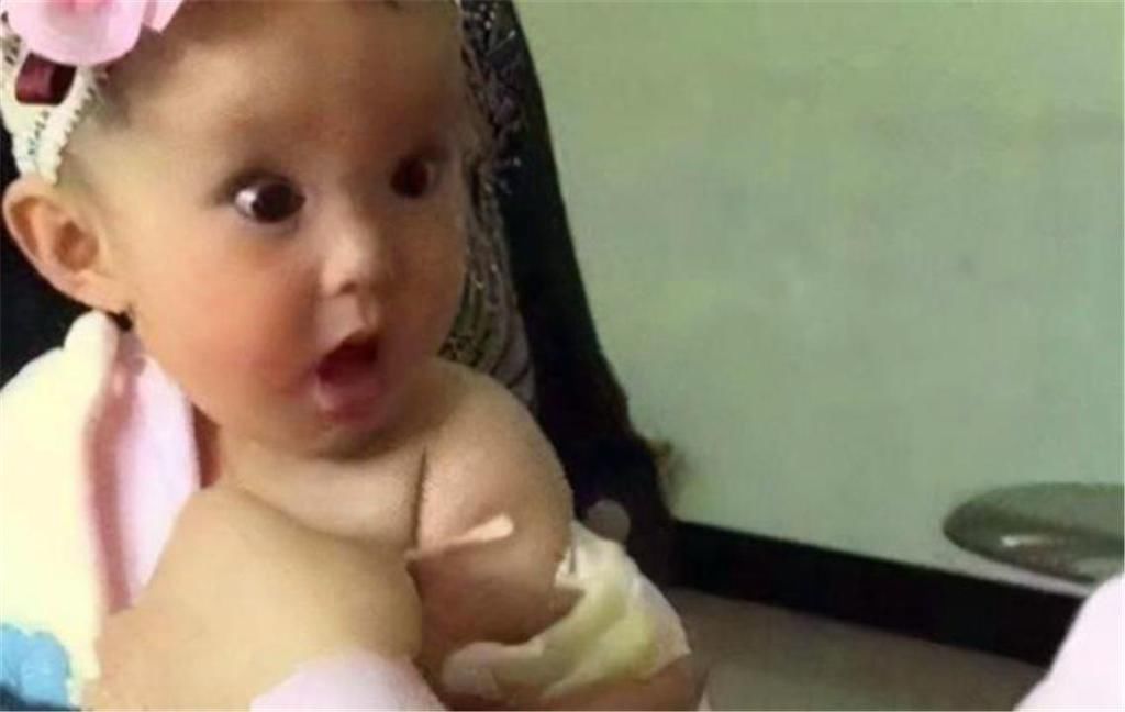 医生|8个月的宝宝接种疫苗,小表情让人忍俊不禁,医生:舍不得下手