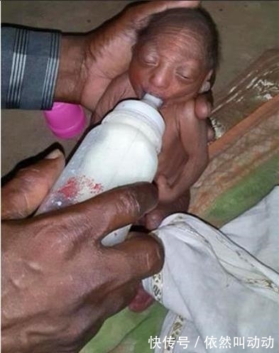 褶皱|母亲生下宝宝，奇丑无比狠心抛弃，爷爷喂奶抚养长大创造奇迹！