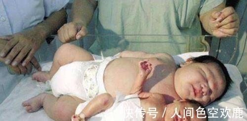 奶水|产妇生下龙凤胎,哥哥吃奶粉,妹妹吃母乳,6个月后差距太大