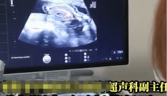 医生|40多岁女子肚子胀气去检查，医生：你怀孕了，孩子脚都出来了