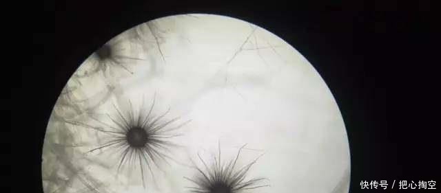 空调|真不是吓唬你！这东西一年不洗，轻则生病重则折寿，赶紧检查一下！