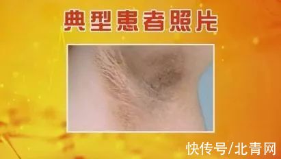 甲亢|各种疾病的早期信号,都在这里了!知道了省钱又救命,赶紧学起来