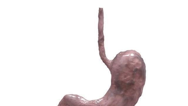 冬病夏治|老中医:肠胃不好的人,4类食物再想吃也别碰,慢慢养出健康胃!