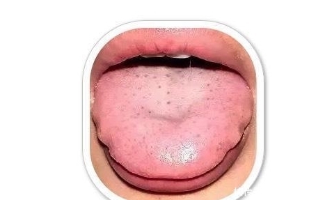 冷饮|阳虚体质的人?什么季节“最”难熬?怎么调理?