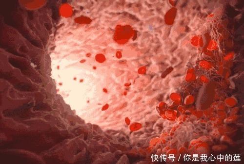 夏天|1块钱1斤的“血管斑块清理工”，抗衰老，夏天一定要常买