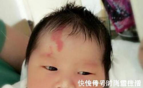 行为|胎记是怎么来的产科医生孕期远离3种行为,避免胎儿长记号