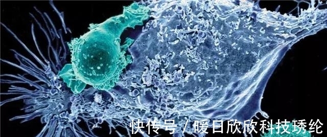 隔离罩|“泡泡男孩”:12岁才走出隔离罩,在死亡前第一次触摸到了妈妈