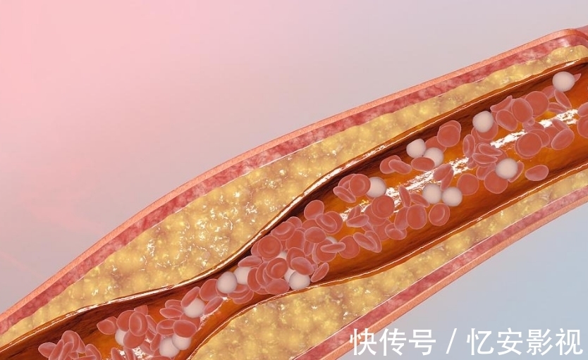 血脂|立秋之后,把“零食”换成它,血脂降了,血管畅通,男女都可以试试