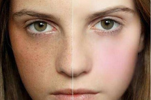 肚腩|睡前若这样拍打肚子，不出一个月，肚腩小了，也许还有助于淡斑