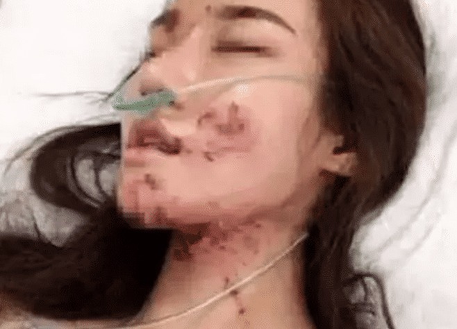 孩子|熊孩子割断安全绳, 害女孩毁容, 谁为 “他还是个孩子”买单