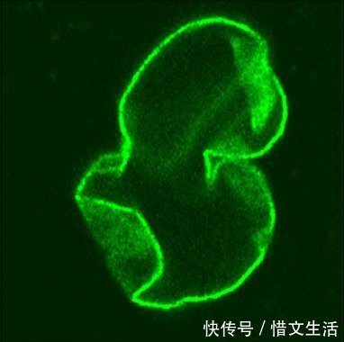 啄木鸟|啄木鸟的嘴会卡在木头里拔不出来吗?