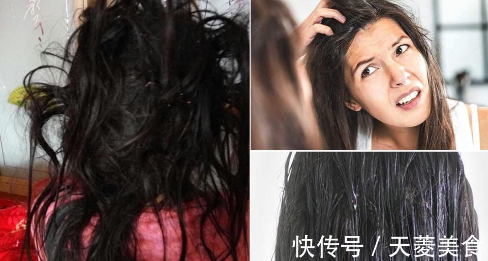 脸大|头发干燥油腻,这些特点让你土气十足,如何补救?