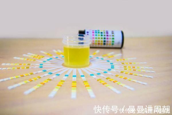 尿蛋白|尿带泡沫就是蛋白尿?若是这几种,不代表身体健康出问题