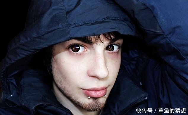 手术|男子花23万削尖耳朵漂白皮肤,每月花3万护理只为成现实中精灵