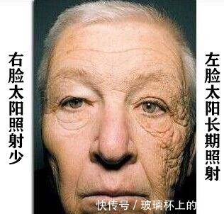 皮肤 经常涂防晒的女人,20年后会怎样天天涂防晒霜,会伤害皮肤吗!