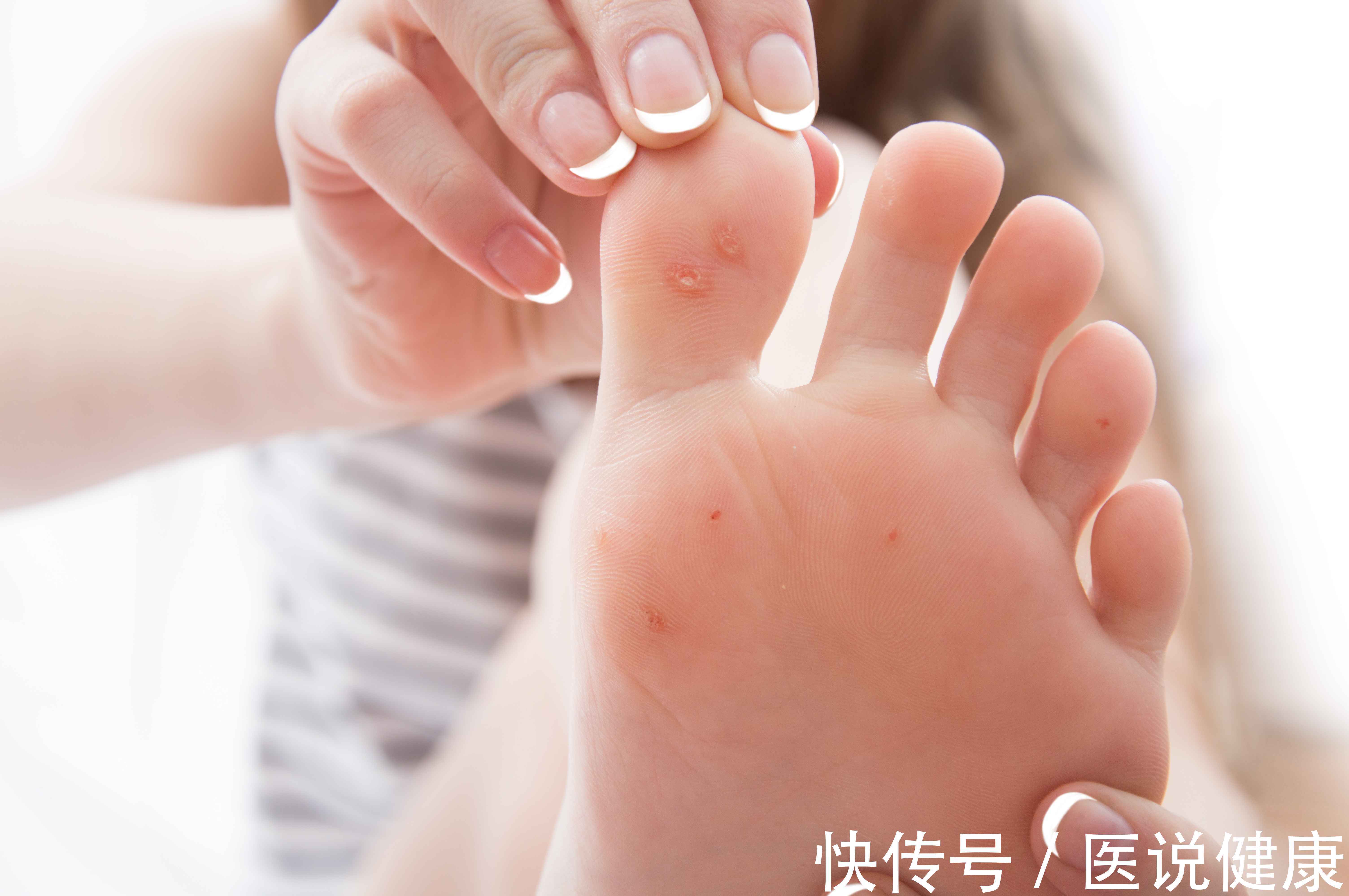 爬行感|手脚若有这4种不适,可能与血糖值升高有关,需多留意一下