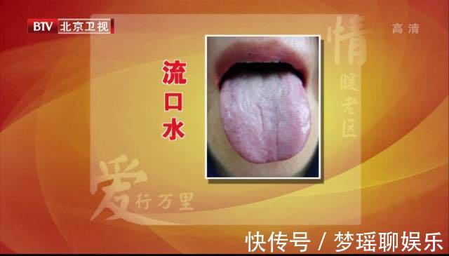 脾阳虚|吃不胖和瘦不了,可能都是“它”惹的祸!一次性告诉你