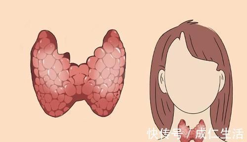 食物|有甲状腺结节的人，3种菜赶紧端下餐桌，不适合你吃，易助长结节