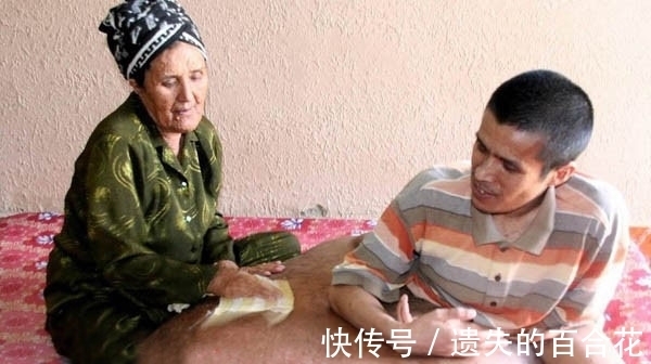 男子|男子的腿长成了一块“大岩石”，天天坐在上面，画面让人害怕