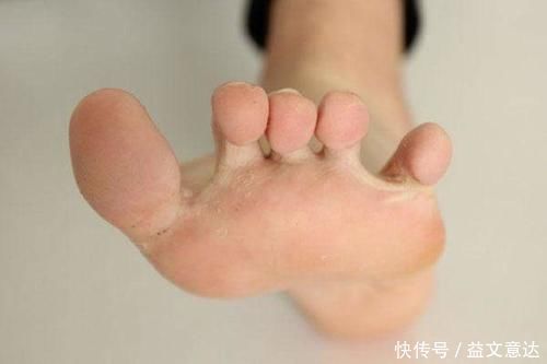 地筋|脚底有条养肝筋，每天揉一揉，疏肝气、排肝毒，补气强身易长寿