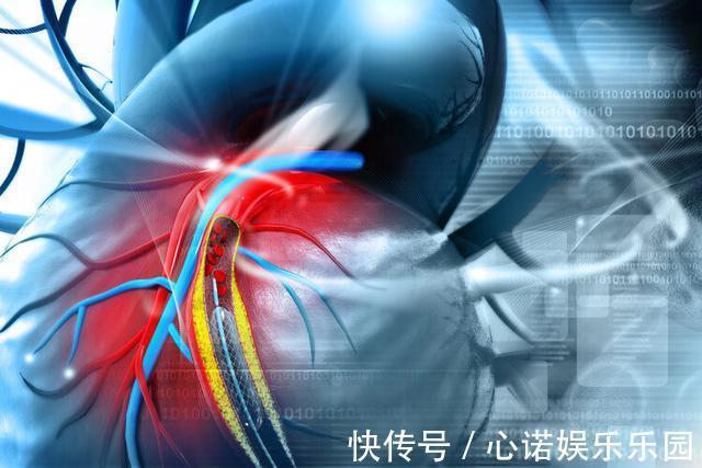 支架|做了心脏支架，病人就活不久了？实话实说，6类人群不适合做
