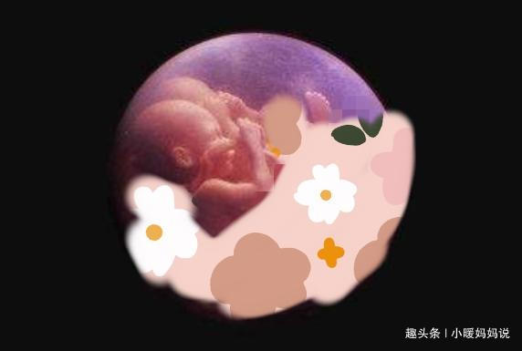 宝妈|孕妇十月怀胎,剖腹产2小时竟生出了“怪胎”,医生恭喜你